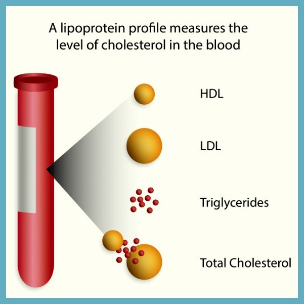lipid profile blood test
